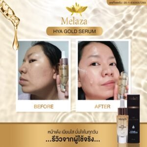 เซรั่มรีวิว5 – re